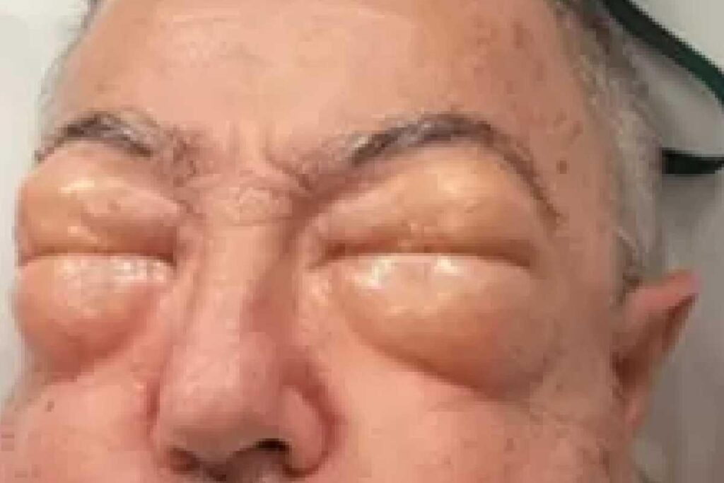 Um australiano de 75 anos teve corpo e rosto alterados após passar por cirurgia