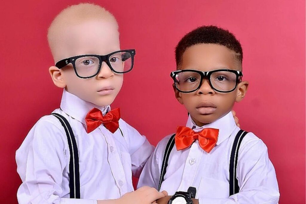 Mãe dá à luz a gêmeos de cores diferentes