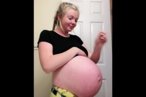 Síndrome do Couvade: condição faz com que homens tenham sintomas de gravidez junto com a parceira