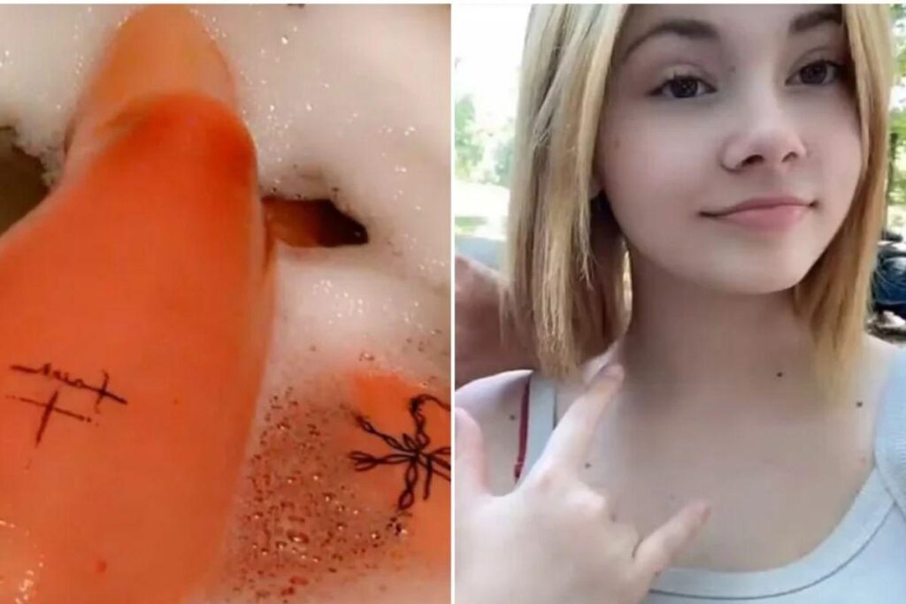 Menina descobre que é alergica a àgua