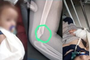 A família ficou indignada pela demora para perceberem a situação crítica do bebê