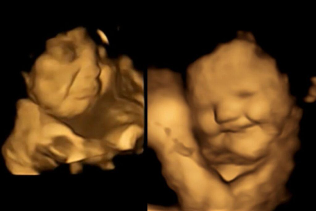 Reação do bebê ao comer cenoura