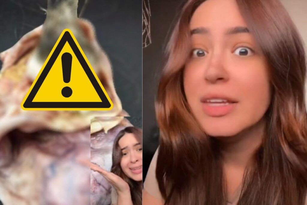 Drielly Arruda descobriu após exames que tinha um tumor teratoma