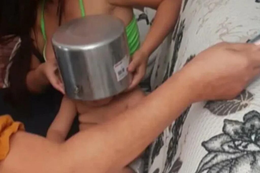 O menino ficou com a cabeça presa na panela de pressão
