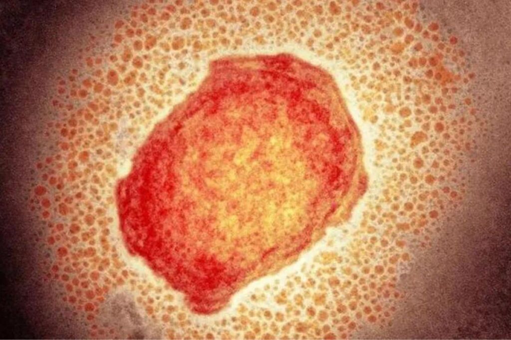 Varíola dos macacos em crianças