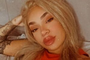 Estado da tatuagem após efeito do creme anestésico