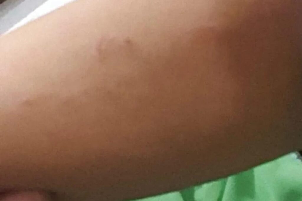 A mãe procurou a escola após o ocorrido