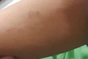 A mãe procurou a escola após o ocorrido