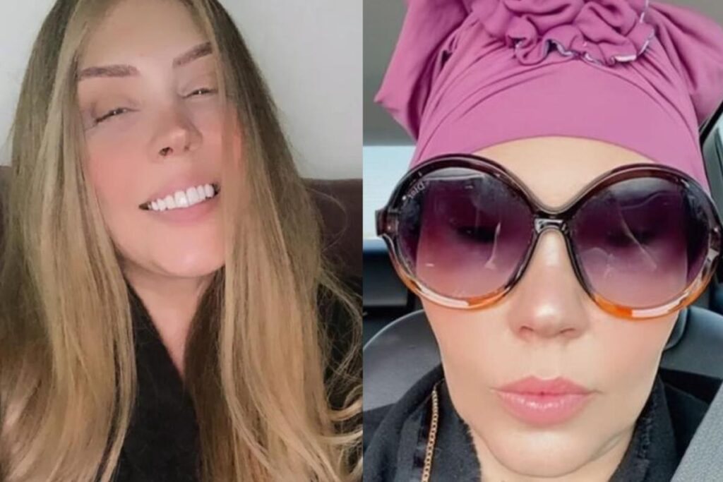 A cantora está enfrentando um câncer e, assim, acabou perdendo seus cabelos