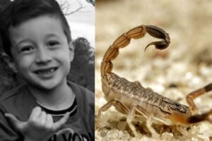 Depois de ser picado por um escorpião, o primeiro passo é lavar a ferida