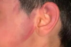 O menino que sofreu violência possui apenas 6 anos e sua identidade não foi revelada