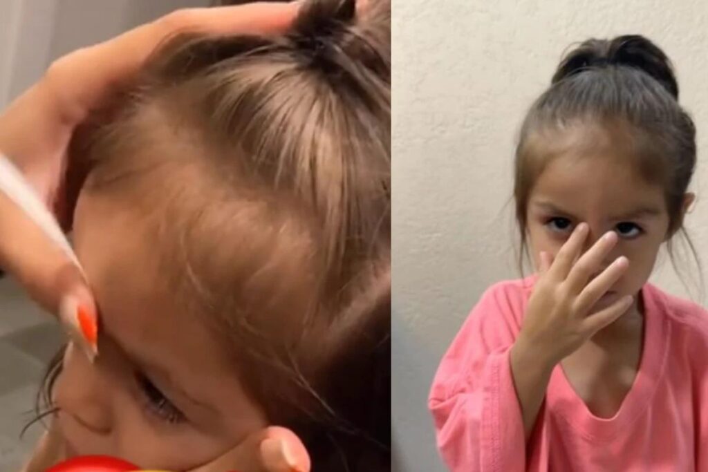 O cabelo da criança ficou preso em um exaustor