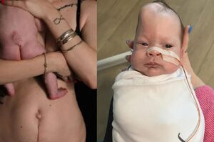 Bebê passou por cirurgia ainda dentro do útero