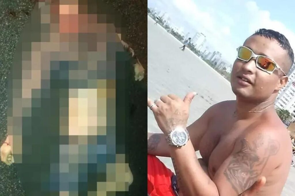 Menino que teve oito costelas e braço fraturados pela mãe e padrasto em São Vicente/SP