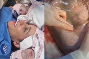 A mãe das meninas gêmeas junto da equipe médica