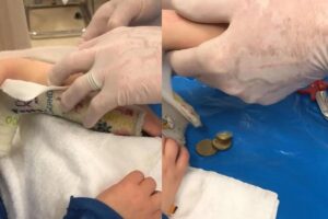 Menino guardava ‘coleção secreta’ em gesso