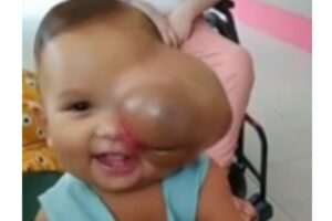 Bebê com câncer raro precisa de remédios caros