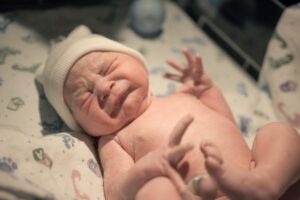 Bebê que nasceu com cauda teve a estrutura retirada quando completou 2 meses de idade