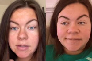 Mãe mostra como o seu nariz inchou durante a gravidez e viraliza