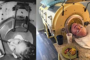 Homem está preso em máquina há 70 anos desde quando tinha 6