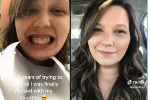 Mulher diz que dentes “apodreceram” na gravidez