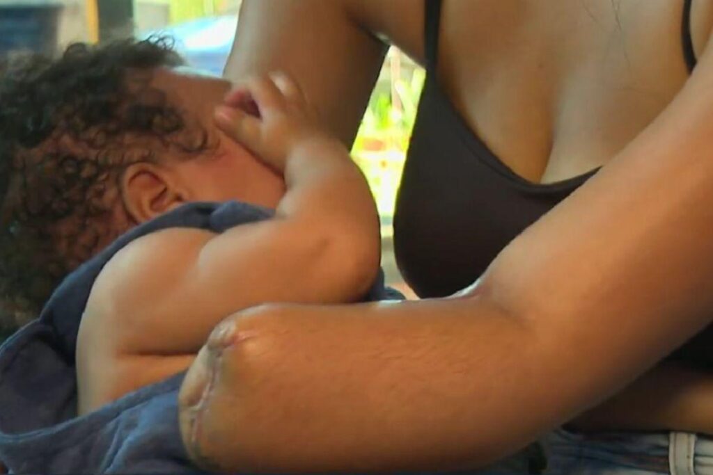 Ela teve mão e punho amputados três dias após o parto