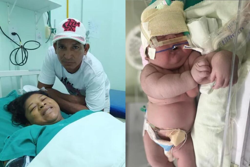 O ‘bebê gigante’ nasceu no Amazonas