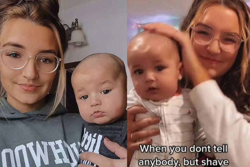 O bebê ficou totalmente sem cabelo