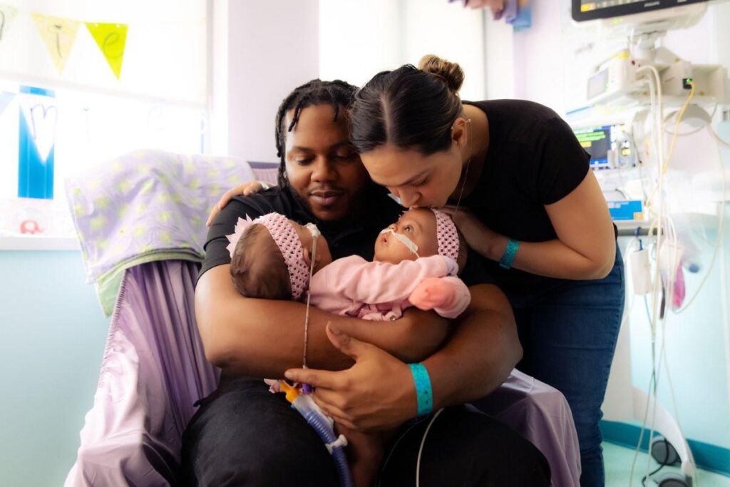 Gêmeas siamesas são sepradas após 11 horas de cirurgia