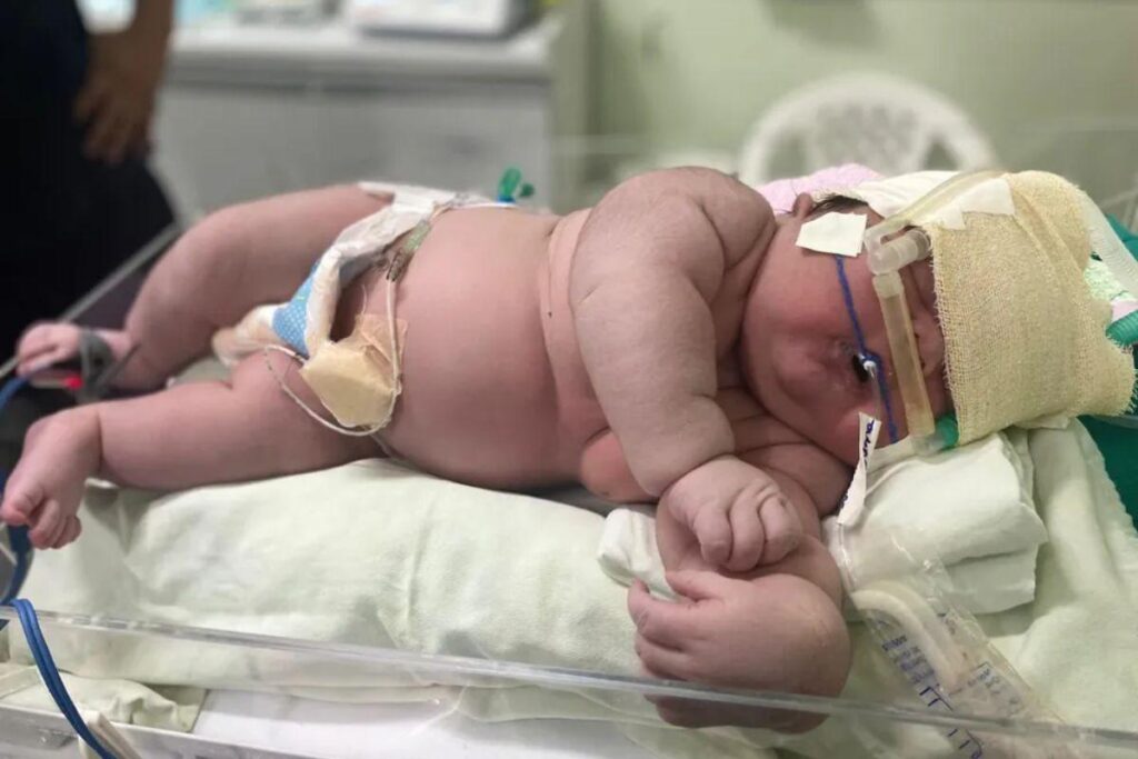 O ‘bebê gigante’ nasceu em Amazonas