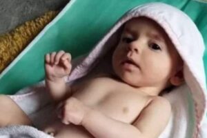 Bebê nasce com marca de nasceça em forma de coração