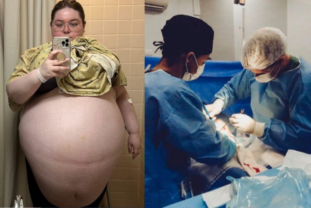 Allison tinha um tumor de 47 kgs