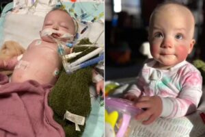 Bebê engole pacote de bolinhas e passa 4 meses no hospital