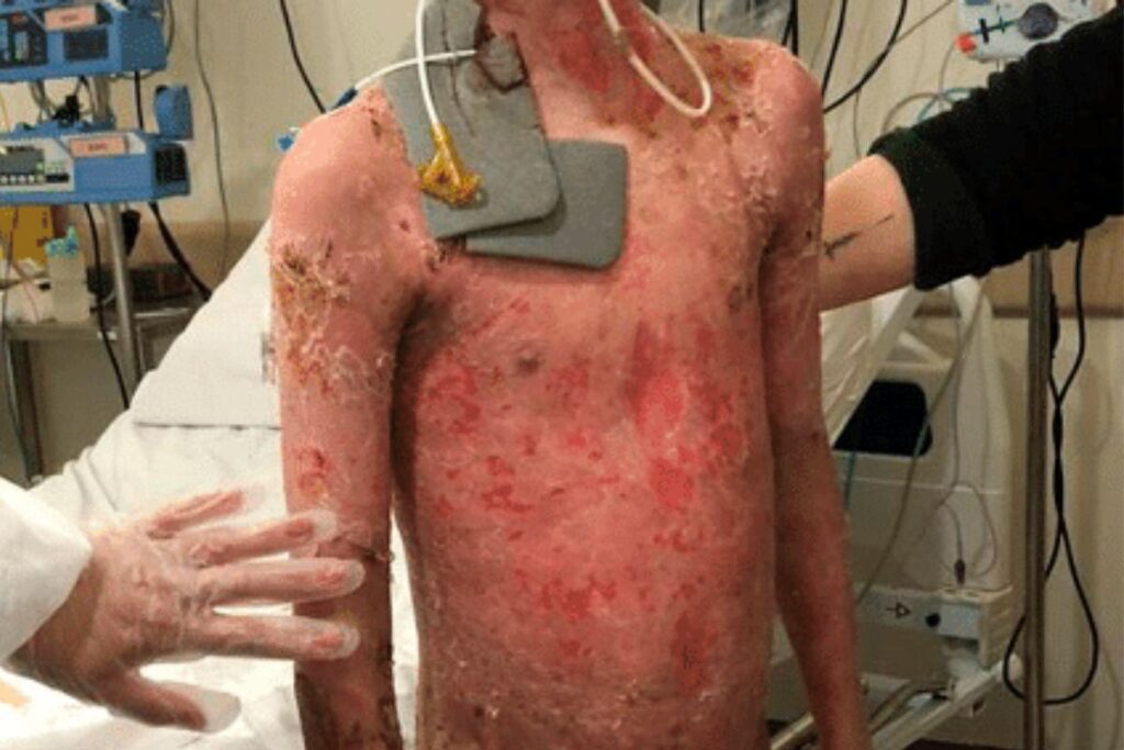 A pele dele foi caindo