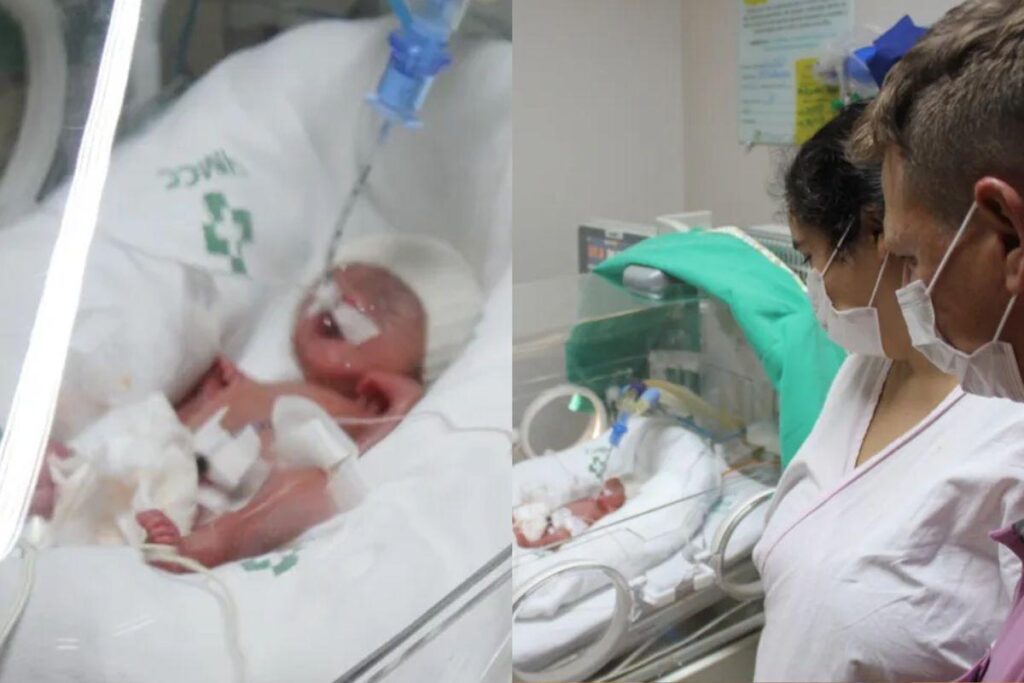 Eles nasceram de 26 semanas com o auxílio de uma enorme equipe médica