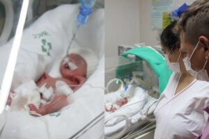 Eles nasceram de 26 semanas com o auxílio de uma enorme equipe médica