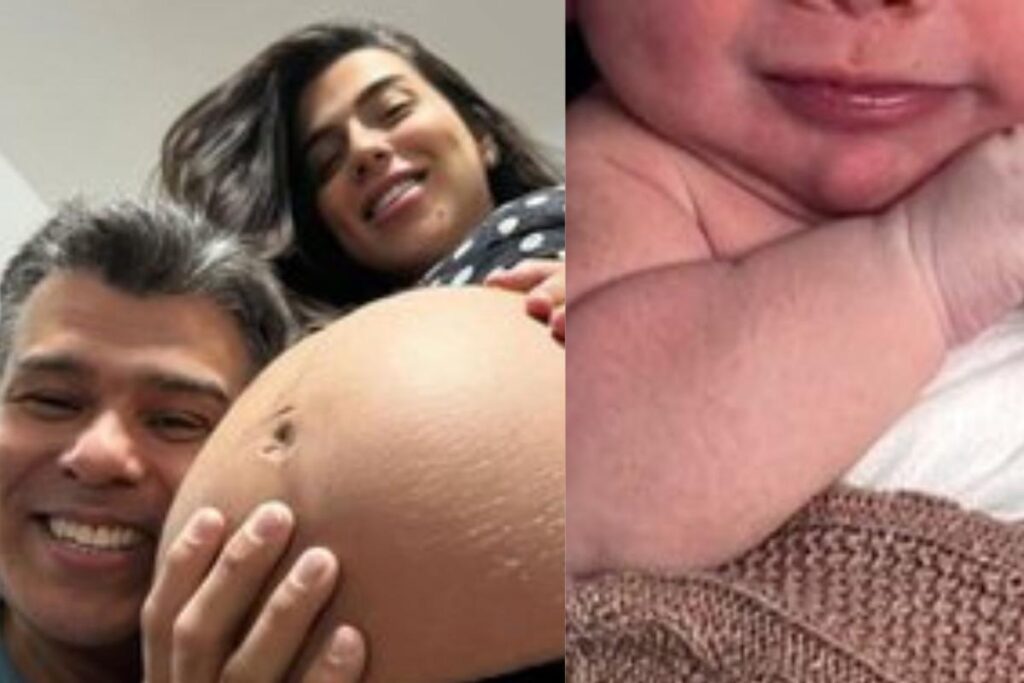 Petra Mattar mostra manchas no rosto do filho