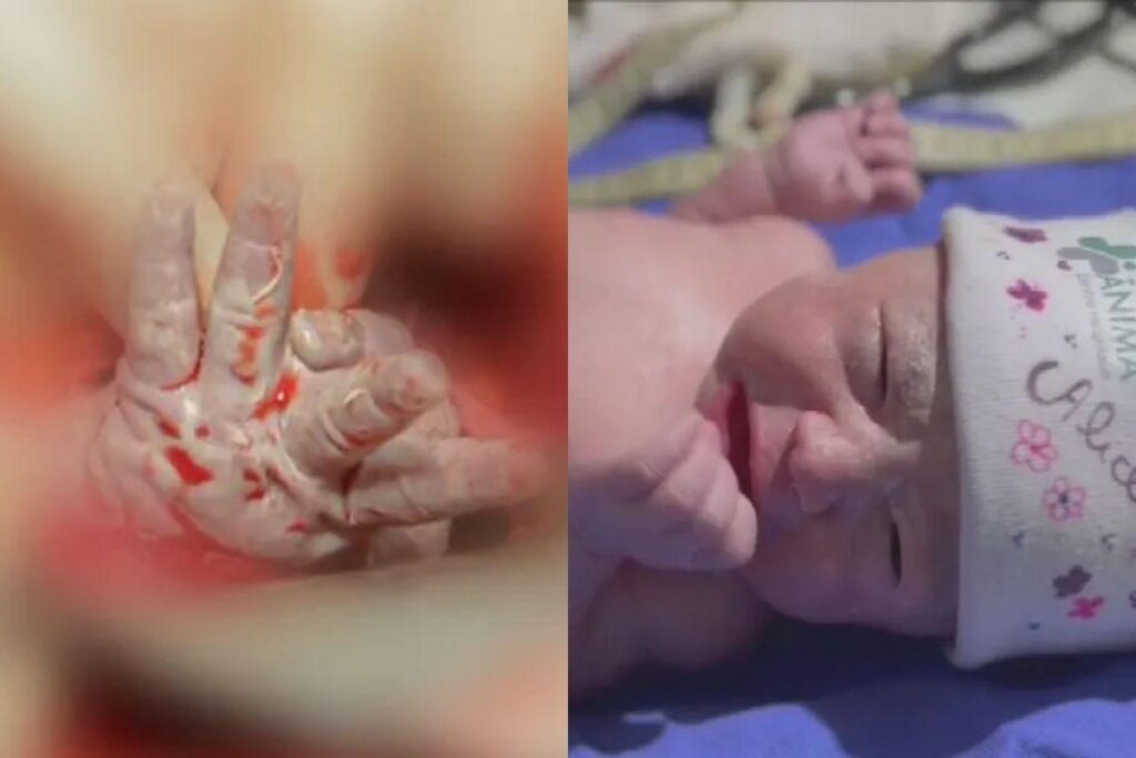 A mãe da menina contou que ela nasceu saudável