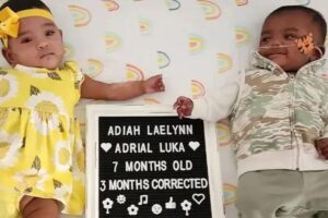 Gêmeos mais prematuros do mundo completando 1 ano