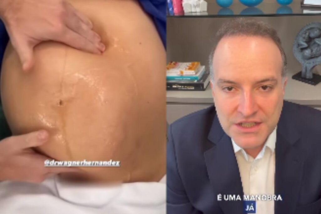 Dr Wagner realizando a manobra Versão Cefálica Externa