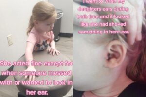 Ela tinha um carrapato a orelha