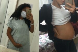 A mulher descobriu um cisto gigante no ovário