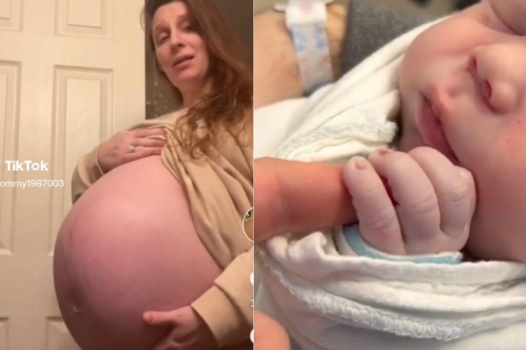 Mulher que viralizou com barriga gigantesca mostra como está filho hoje