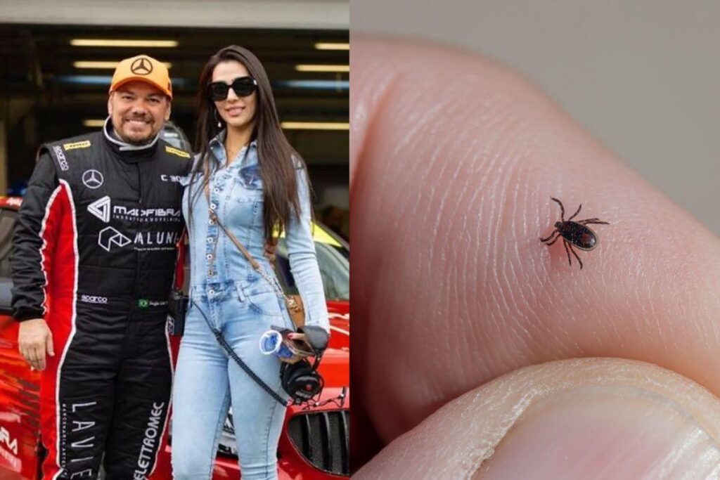 A dentista Mariana Giordano e o piloto Douglas Costa foram hospitalizados com um febre intensa e fortes dores de cabeça