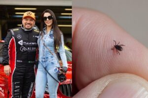 A dentista Mariana Giordano e o piloto Douglas Costa foram hospitalizados com um febre intensa e fortes dores de cabeça