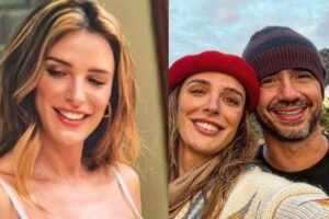 Rafa Brites fala sobre truque que usa para esconder cicatriz