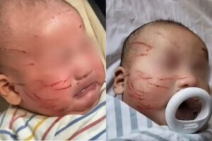 O bebê apareceu todo arranhado