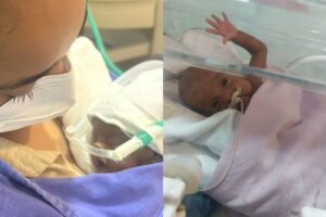 Thuany nasceu com 23 semanas