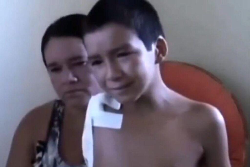 O menino teve o braço amputado
