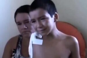 O menino teve o braço amputado